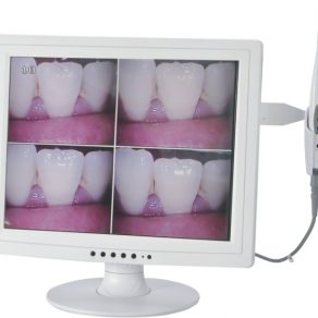 .Intra Oral Camera + 15" LCD Monitor